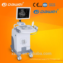 China medical ultrasound equipment & sonography machine